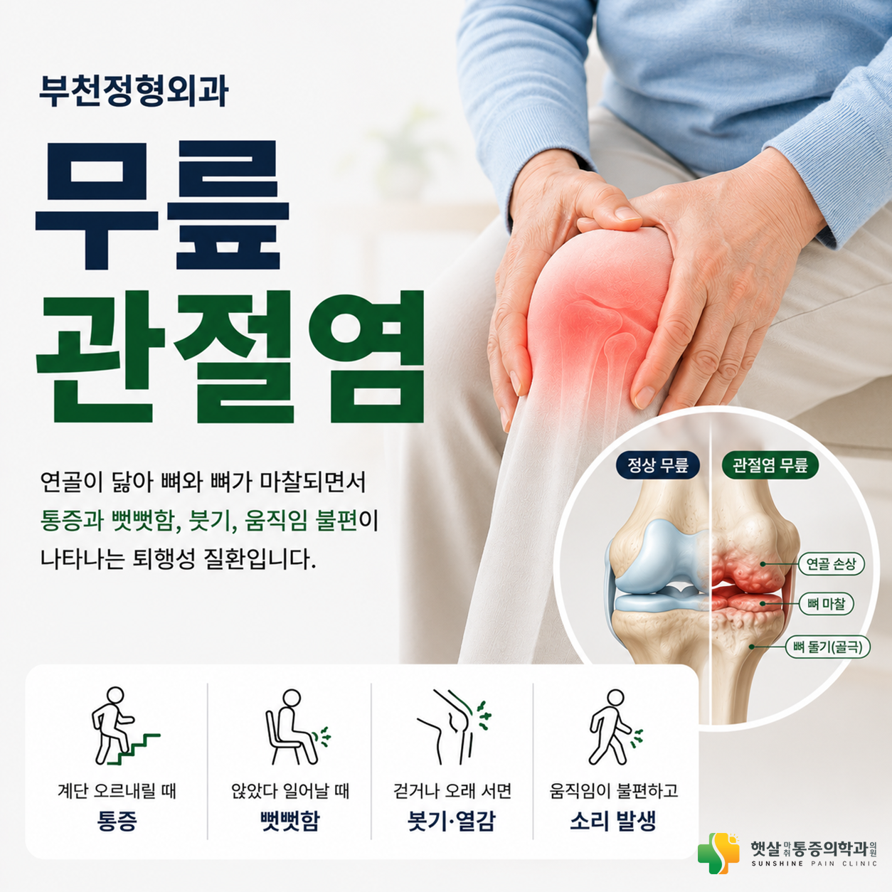부천정형외과 무릎관절염, 오래 방치하면 어떤 변화가 생길까요?